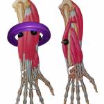 2-HANDY-CARE-RING-HOITORENGAS-hierontarengas-massage-ring
